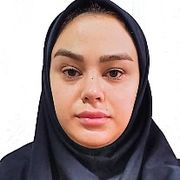 رویا چوپان زیده