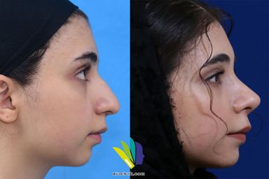 دکتر فرشید آچاک 11