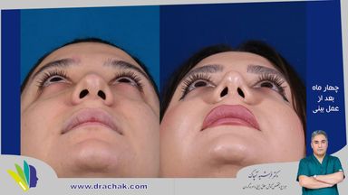 دکتر فرشید آچاک 3