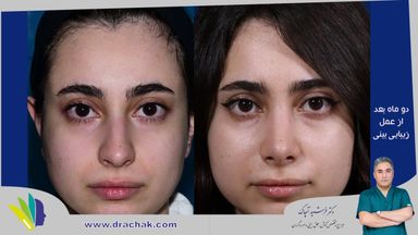 دکتر فرشید آچاک 2