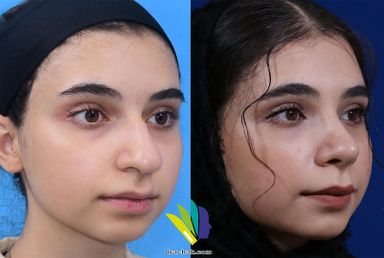 دکتر فرشید آچاک 14