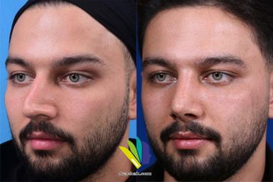 دکتر فرشید آچاک 8