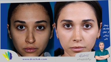 دکتر فرشید آچاک 13