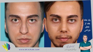 دکتر فرشید آچاک 1