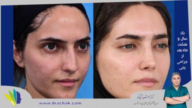 دکتر فرشید آچاک 10