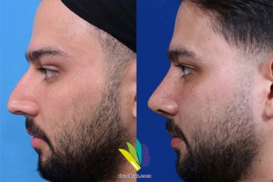 دکتر فرشید آچاک 9