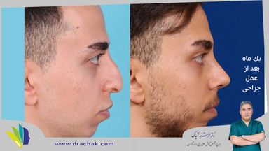 دکتر فرشید آچاک 5