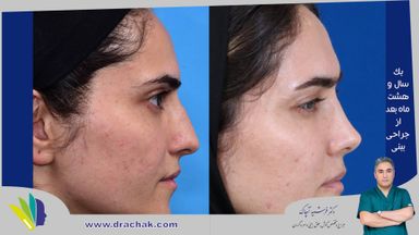 دکتر فرشید آچاک 15