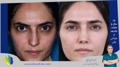 دکتر فرشید آچاک 4