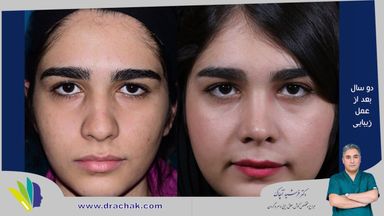 دکتر فرشید آچاک 12