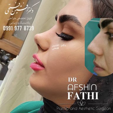 دکتر افشین فتحی 4