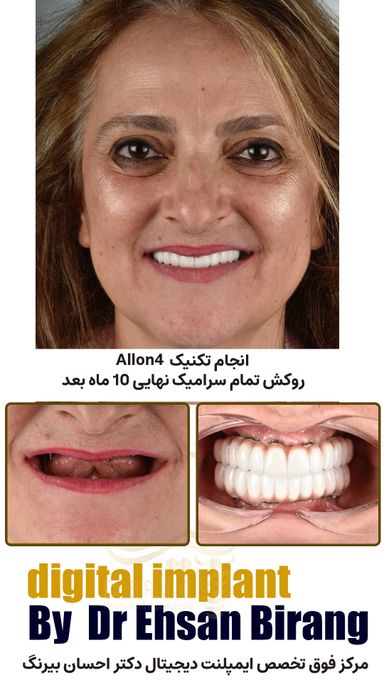 دکتر احسان بیرنگ 3