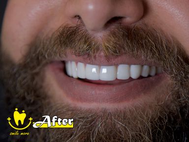 دکتر سیمین برنگی 1