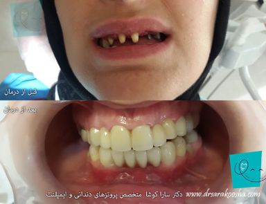 دکتر سارا کوشا 2