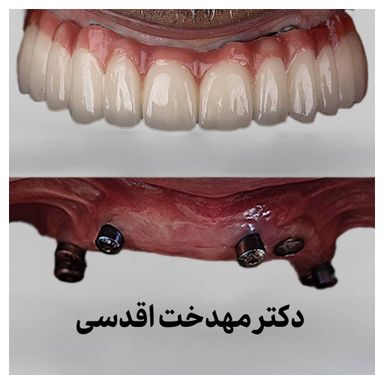 دکتر مهدخت اقدسی 4