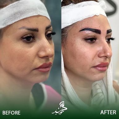 کلینیک زیبایی خورشید تهران 2