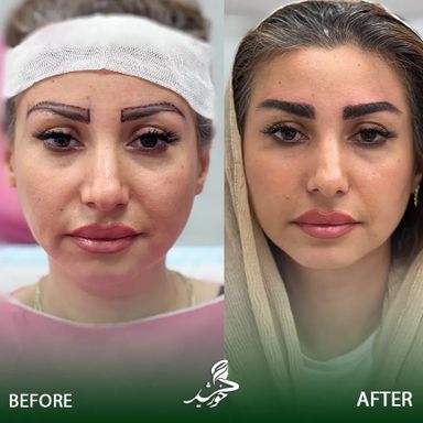 کلینیک زیبایی خورشید تهران 3