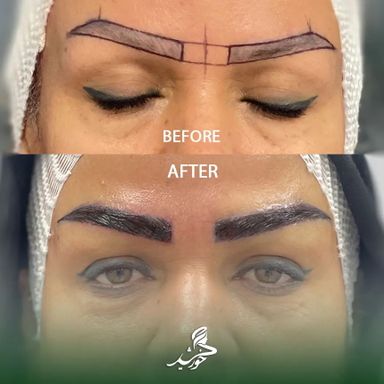 کلینیک زیبایی خورشید تهران 1