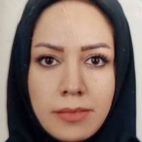 مژگان منفرد