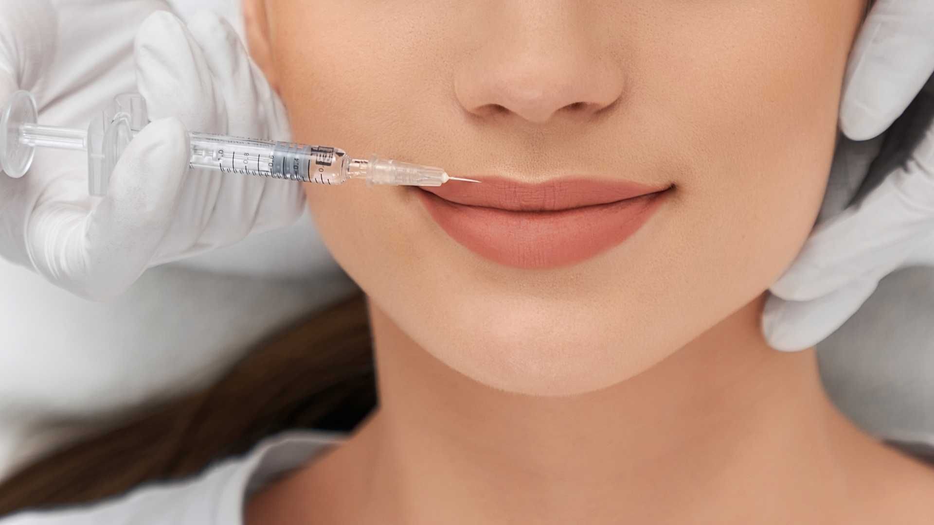 تزریق ژل (لب) برند نورامیس
