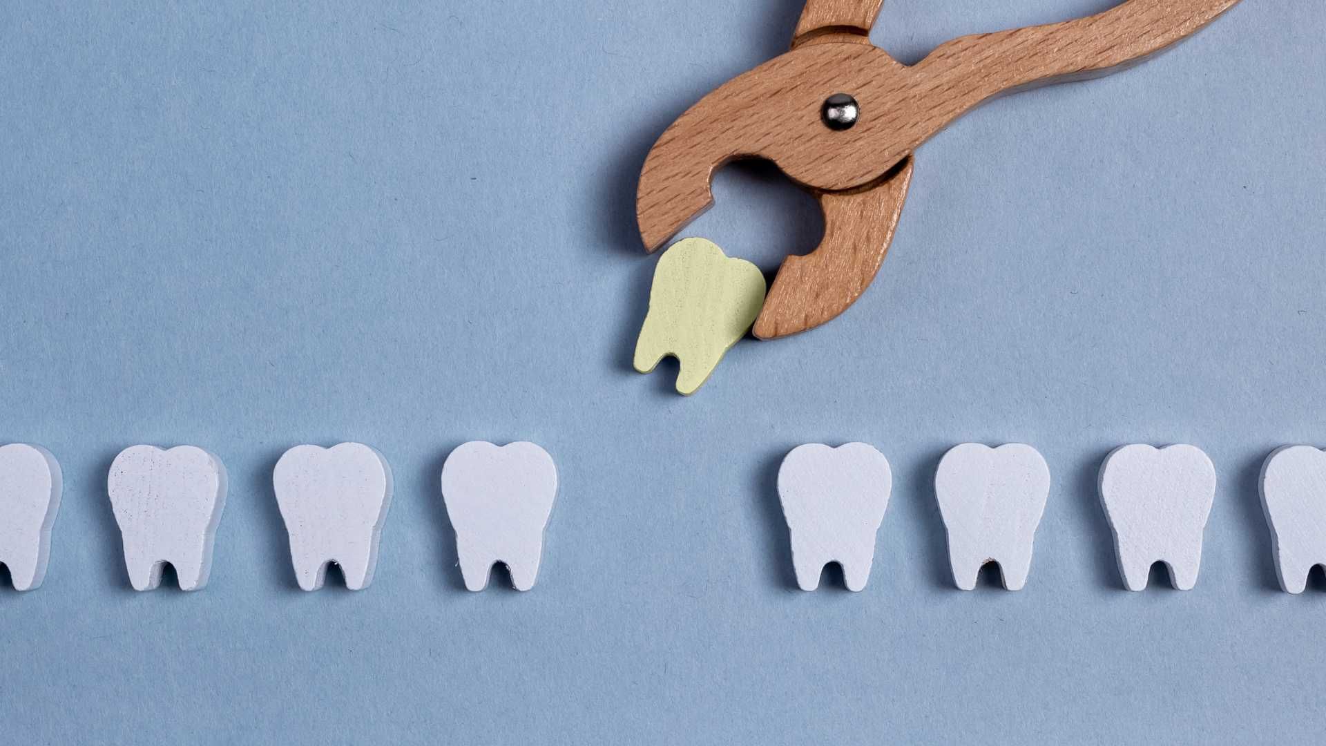 کشیدن دندان (دندان شماره 5)
