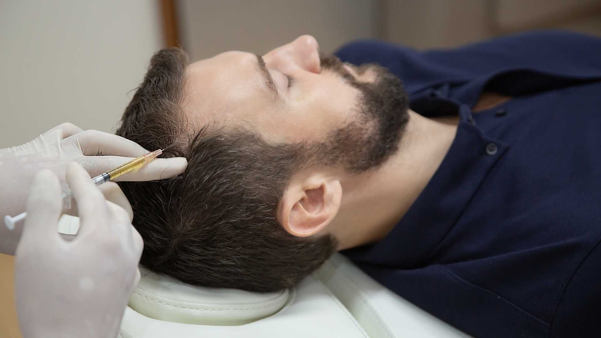 مزوتراپی موی سر با برند رویتاکر (1cc) دکتر شیوا پاکروان در یزد 1