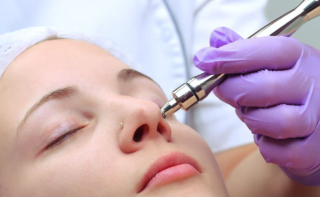 فیشیال پوست به روش میکرودرم آبریژن(هر جلسه)