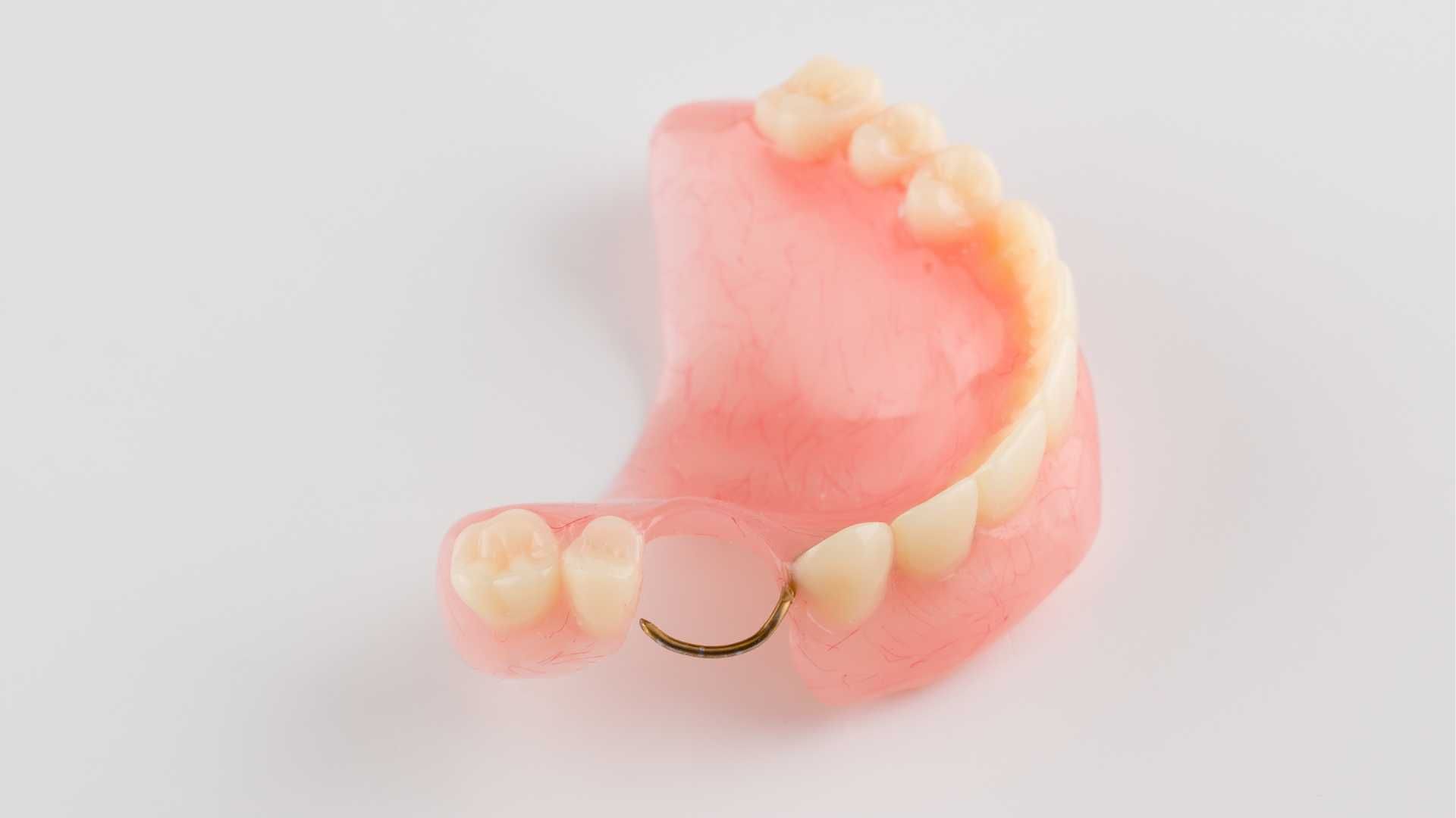 پروتز ثابت هر دندان pfm