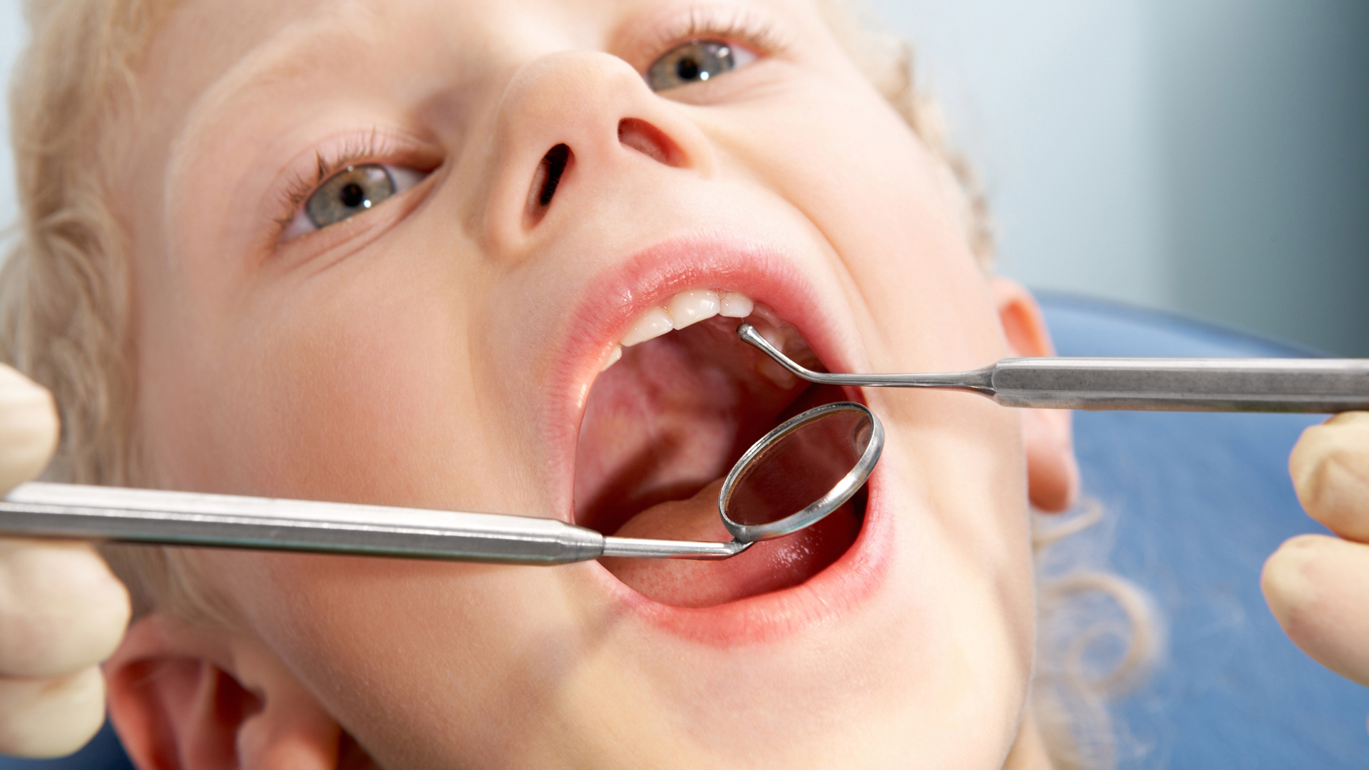 پالپکتومی عصبکشی دندان اطفال