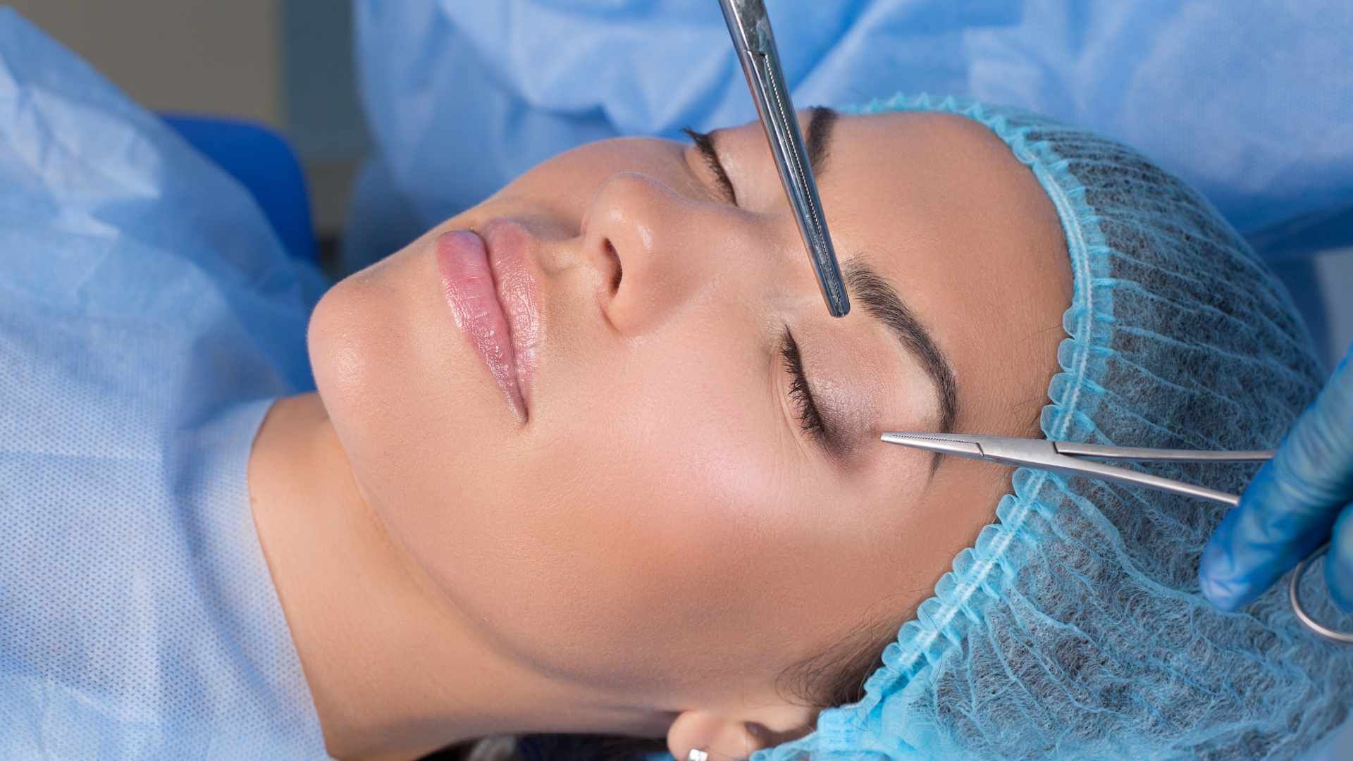 رفع افتادگی پلک به روش جراحی بلفاروپلاستی (پلک بالا) دکتر ابوالفضل بهجو در شیراز 1