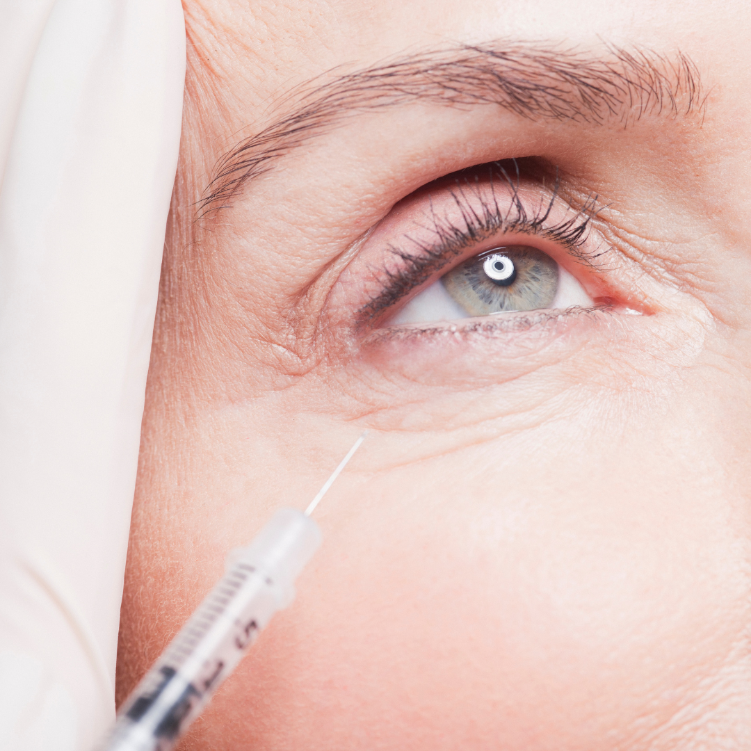 تزریق ژل زیر چشم با برند نورامیس (1cc) دکتر لیلا گزین در شیراز 1