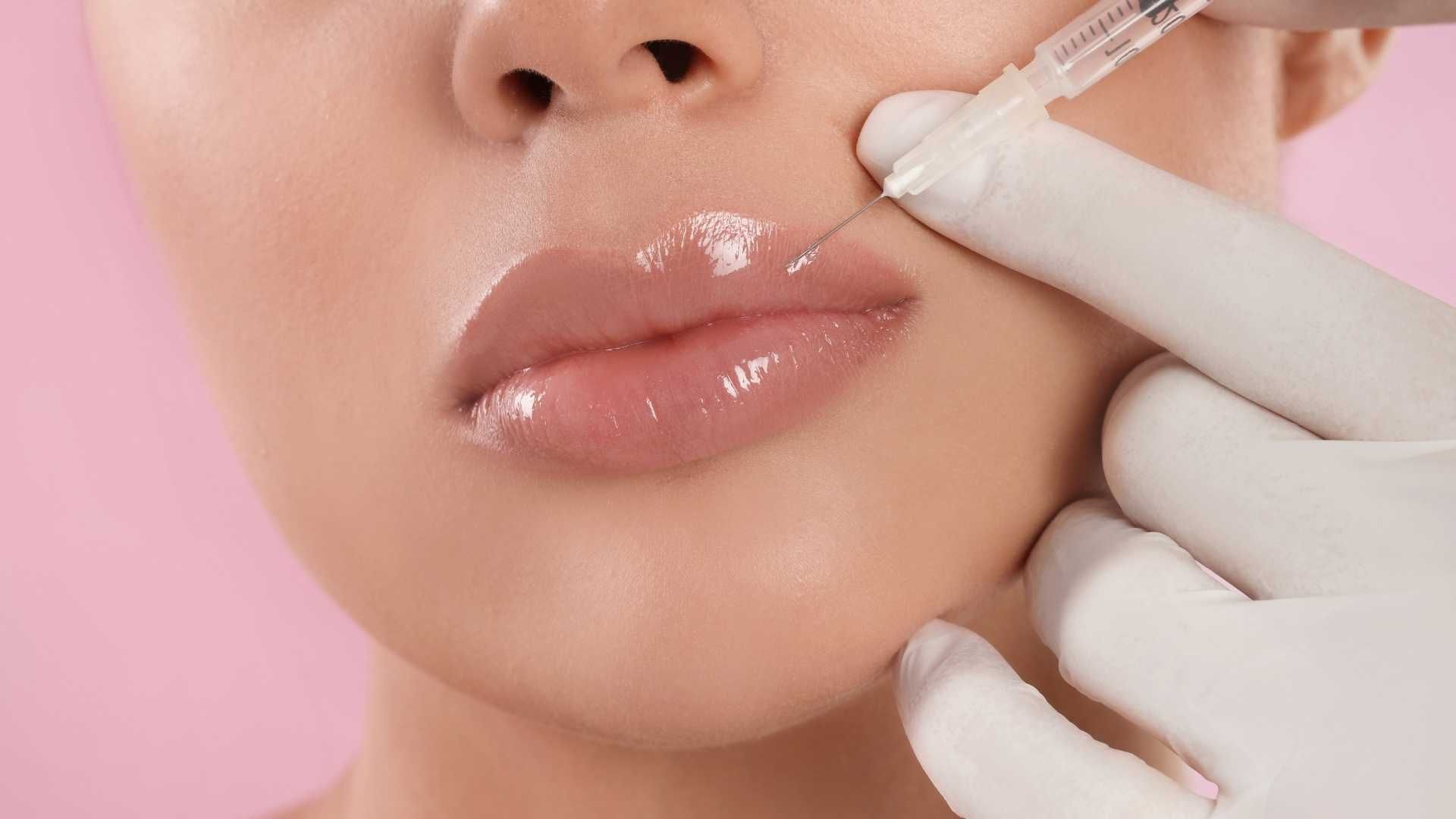 جوانسازی صورت با مزوژل با برند پروفایلو (1 جلسه)