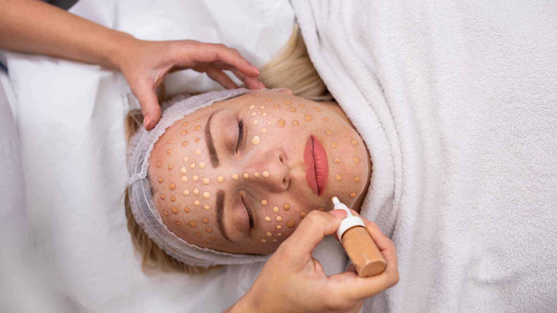 تزریق (ژل) فیلر کانتورینگ صورت با مواد کره ای (1cc)