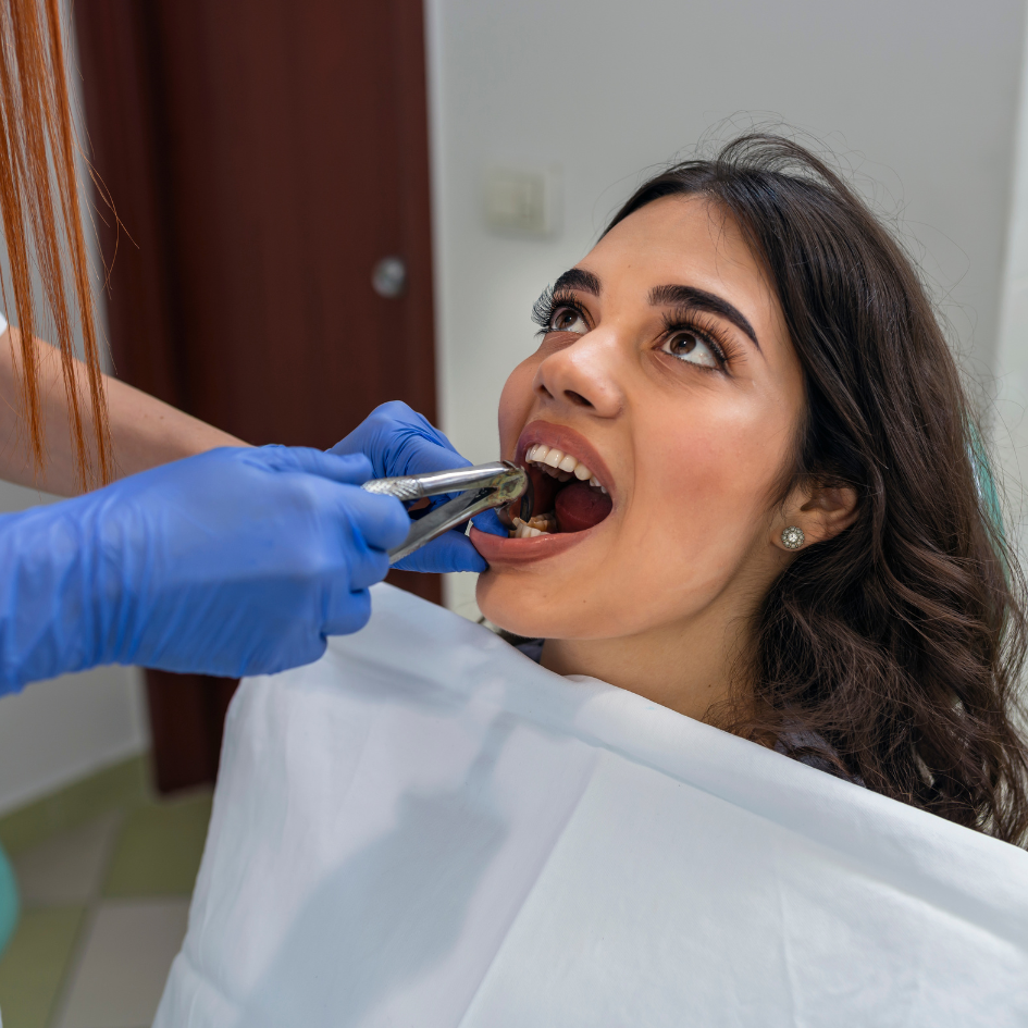 جراحی دندان (دندان عقل)