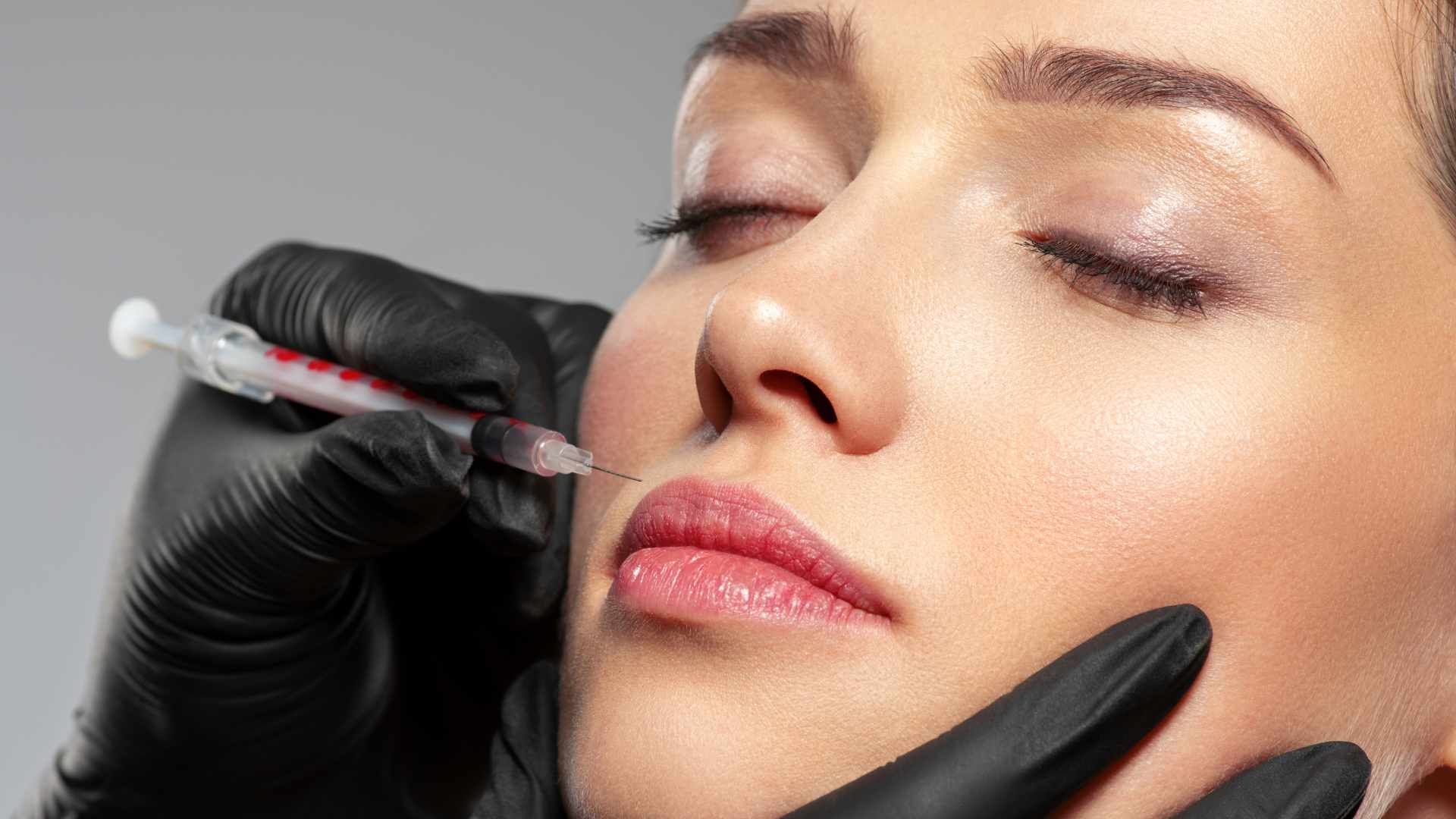 تزریق ژل خط لبخند (1cc)