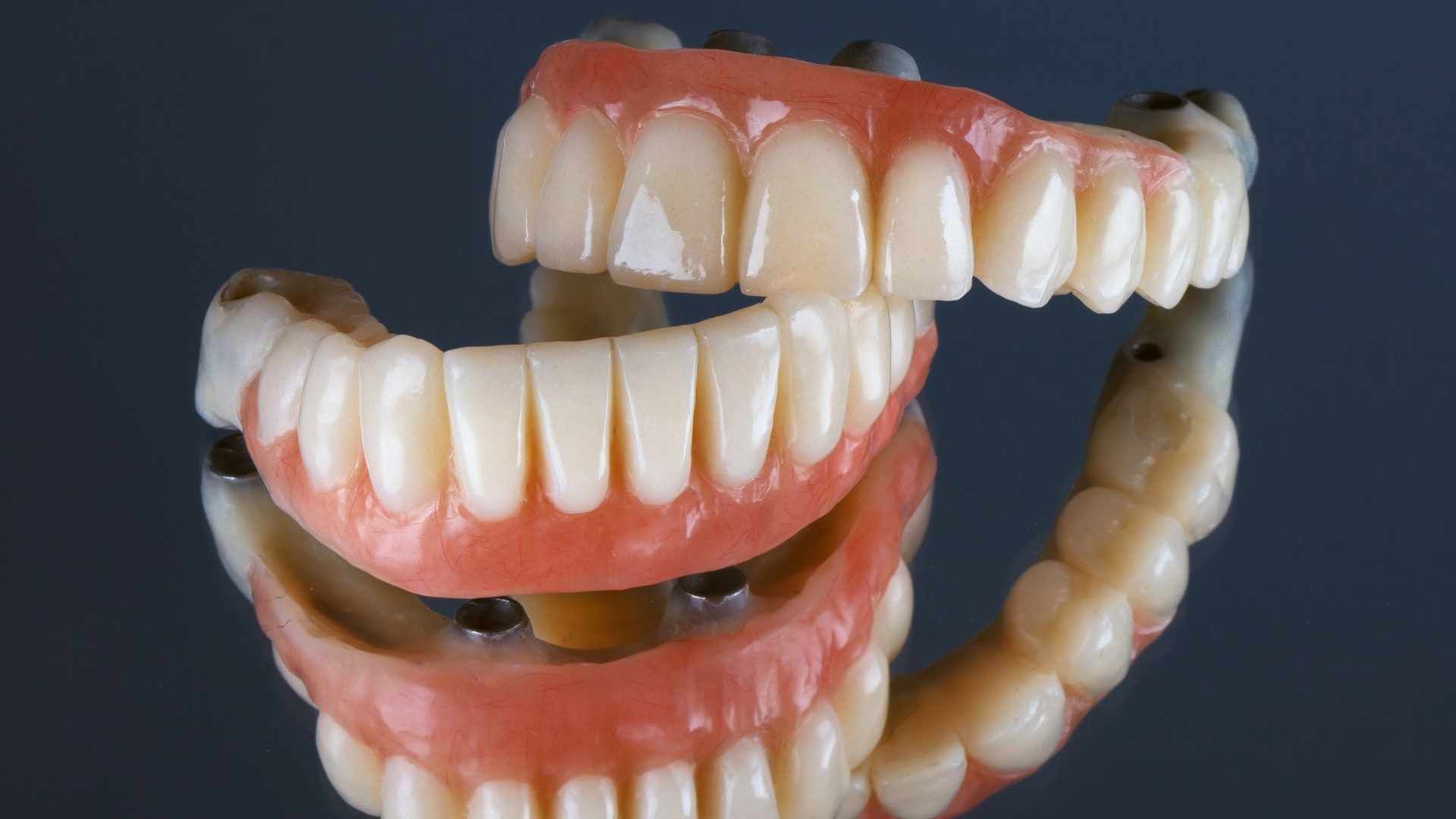 دندان پروتز متحرک (دندان مصنوعی کامل) (دو فک) دکتر کاملیا علیجانی در تهران 1