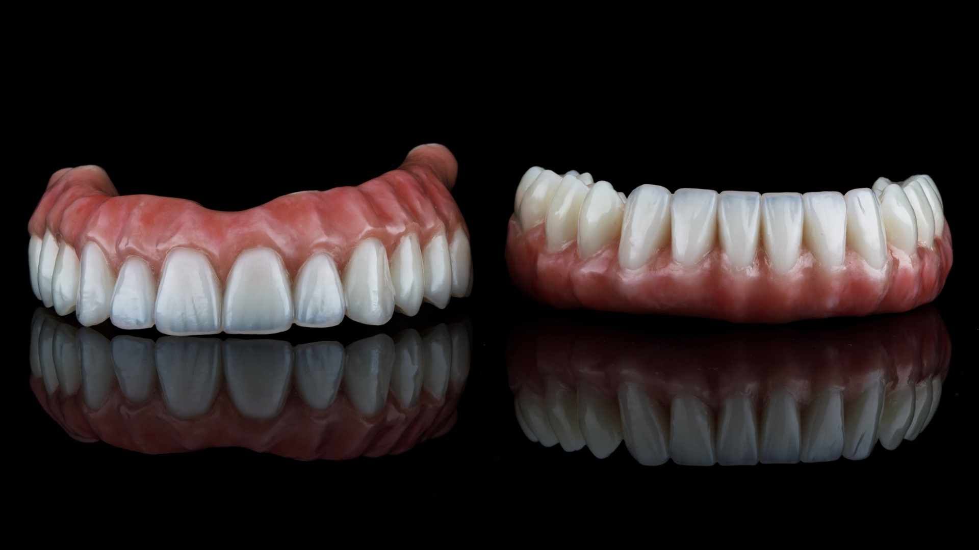 دندان پروتز متحرک (دندان مصنوعی کامل) (یک فک)