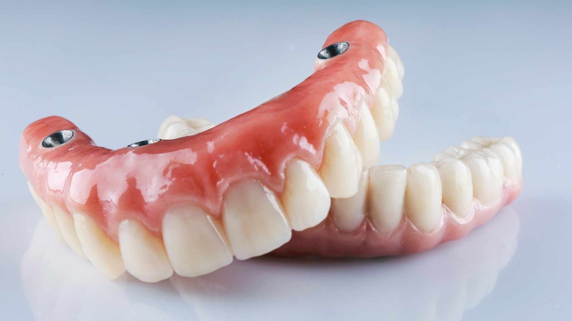 دندان پروتز متحرک آمریکایی (دندان مصنوعی کامل) (دو فک) دکتر سید علی کمونه در کرج 1