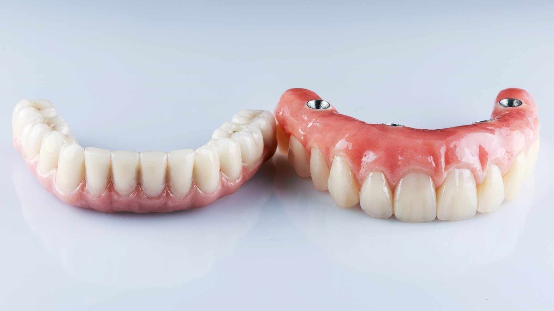 دندان پروتز متحرک (دندان مصنوعی کامل) یک فک