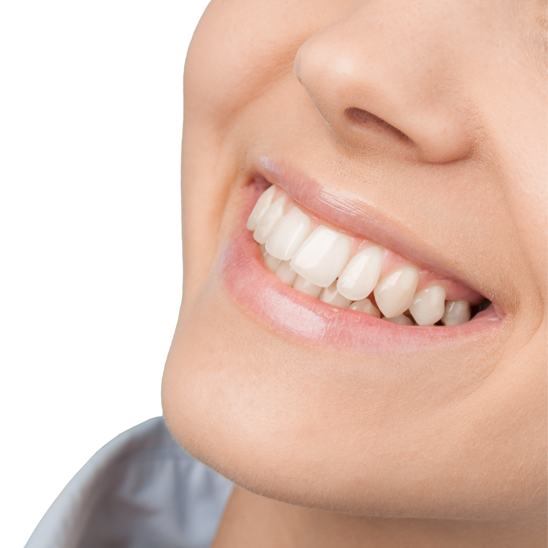 پرکردن دندان سه سطحی با کامپوزیت ژاپنی دکتر مریم احدی در شیراز 1