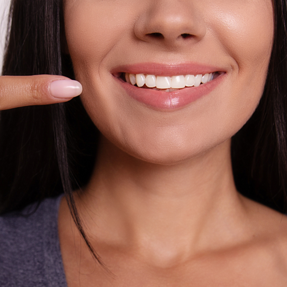 پرکردن دندان دو سطحی با کامپوزیت ژاپنی