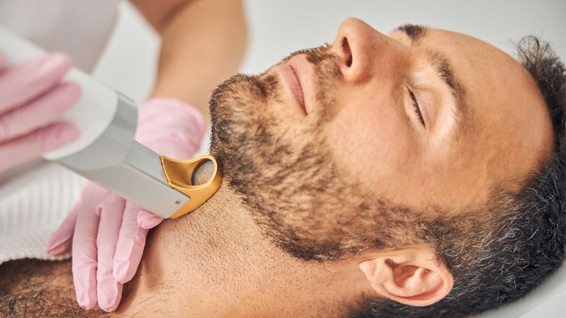 لیزر آقایان کل بدن با دستکاه اسکلپیون