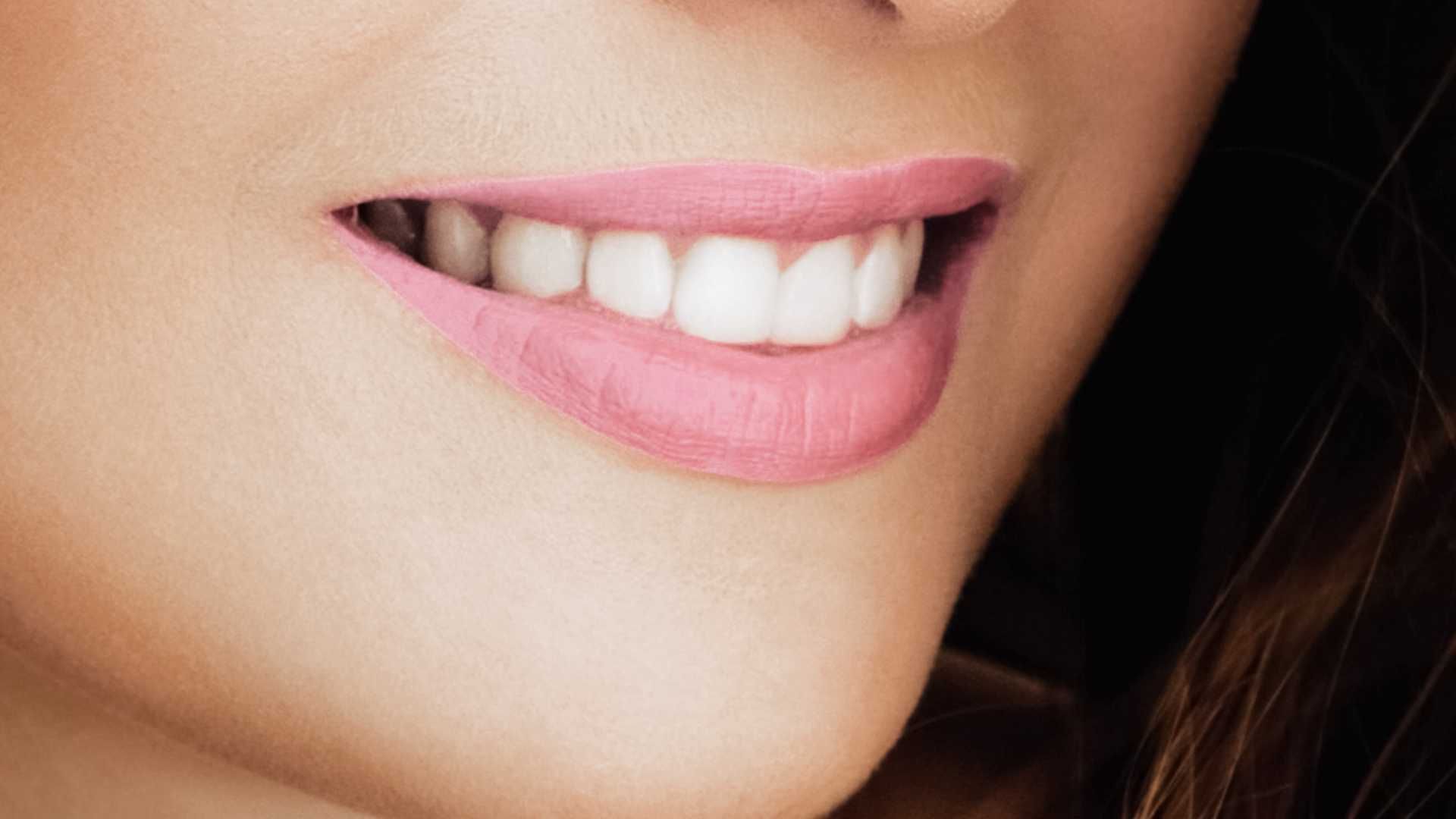 پرکردن دندان شیری دو سطحی با کامپوزیت ژاپنی