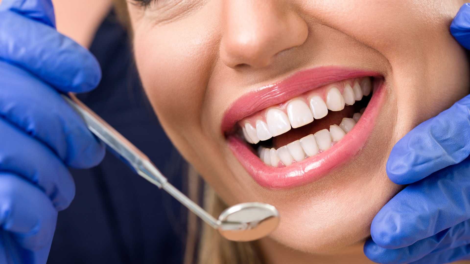 پرکردن دندان 3 سطحی با ماده کامپوزیت سوئیسی