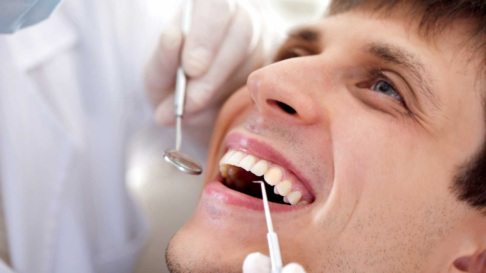 پرکردن دندان سه سطحی با آمالگام