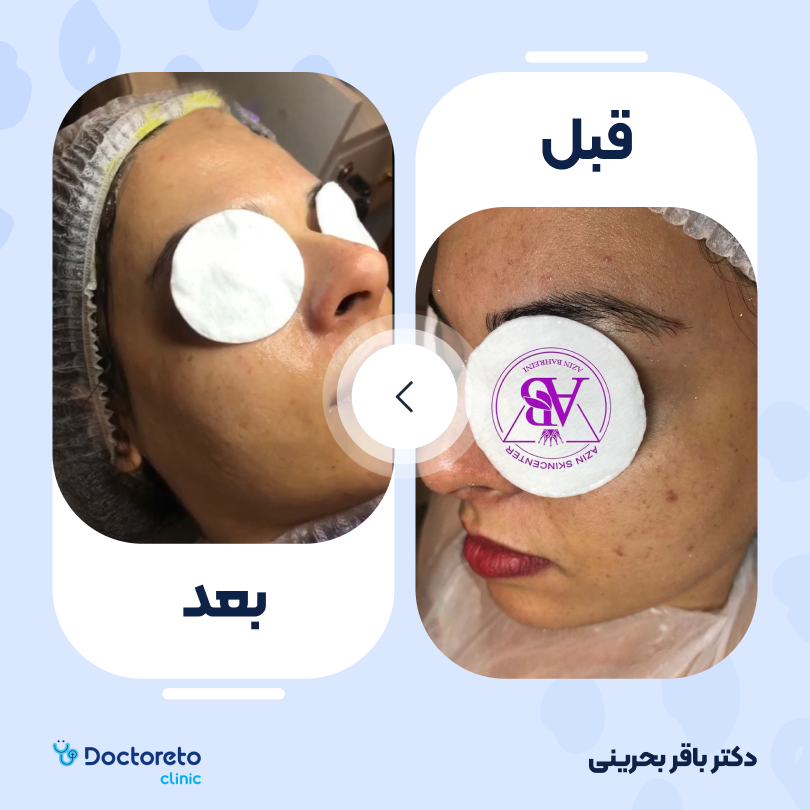 فیشیال کلاسیک (پاکسازی) صورت دکتر باقر بحرینی در کرمان 2