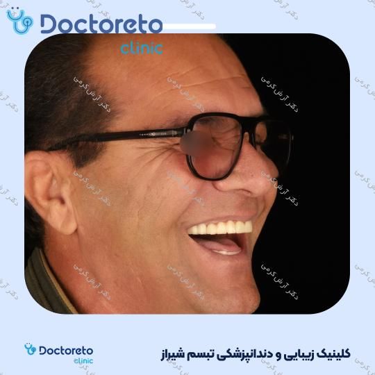 ایمپلنت دیجیتال dio کره ای با روکش (هر واحد) دکتر آرش کرمی در شیراز 63