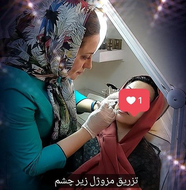 جوانسازی صورت با مزوژل هیارون کره ای (هر جلسه) 🌷 (عید نوروز) دکتر فاطمه قدرتی در شیراز 2