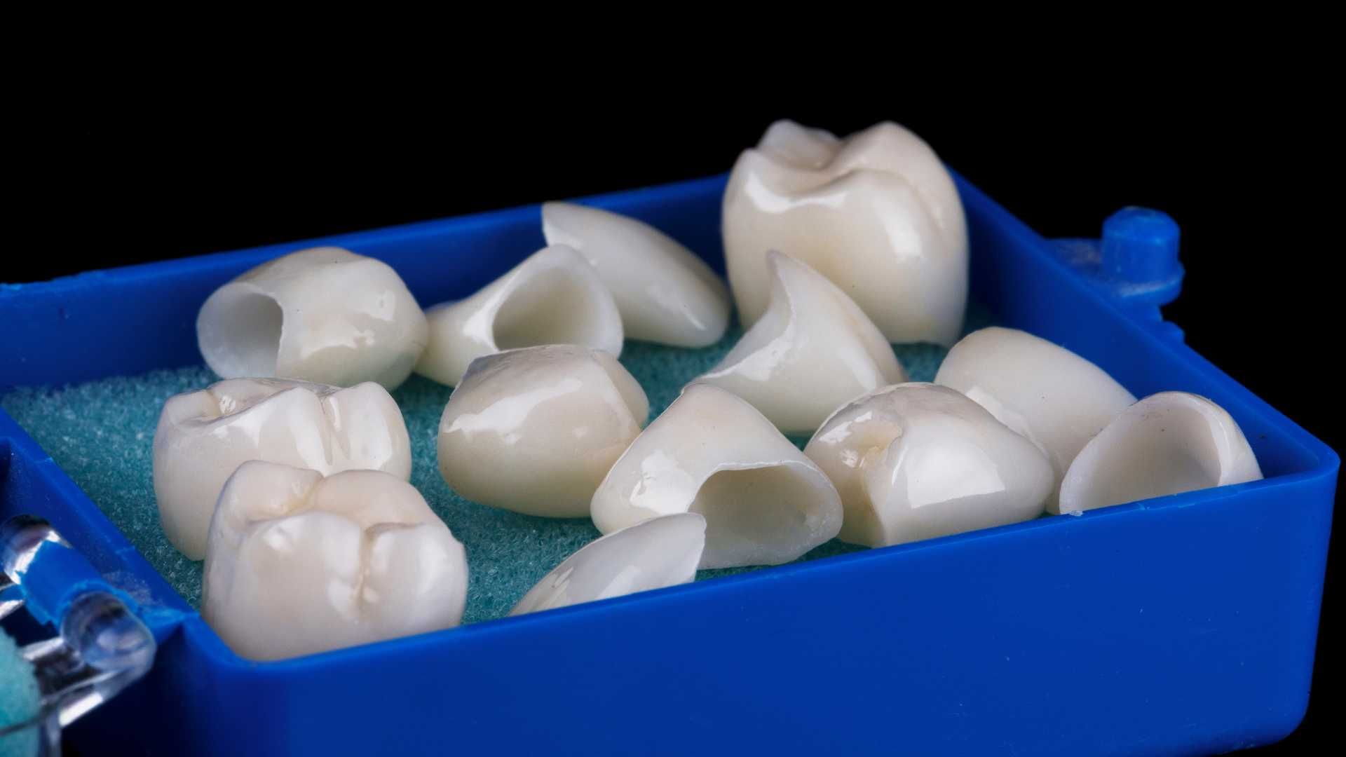 روکش دندان زیرکونیا (هر واحد)
