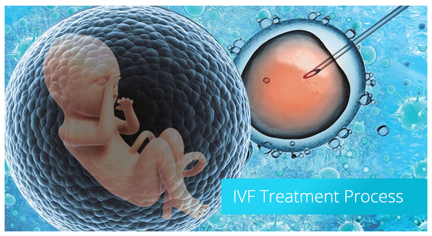 درمان ناباروری به رو ش IVF